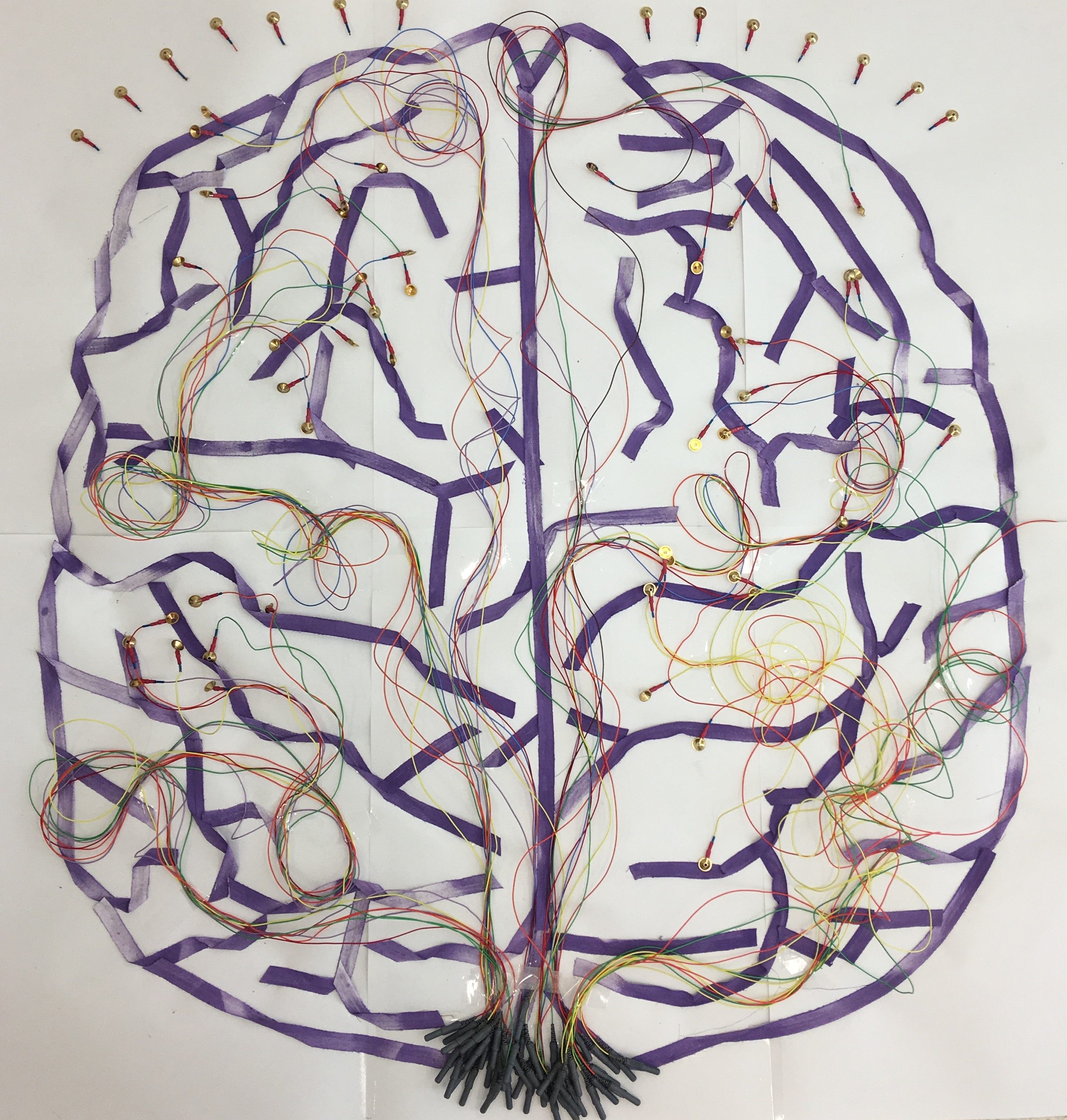 'Epilepsy: A Neurophysiology Technician’s World' - Laura Maclean